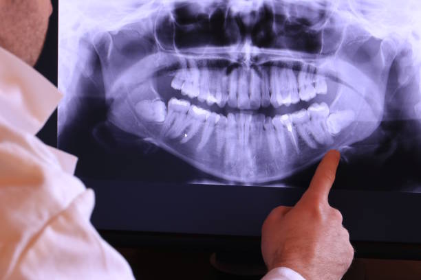 Best Chipped Tooth Repair Near Me  in Pascoag, RI