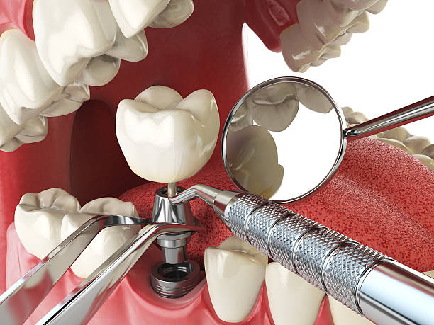 Best Urgent Tooth Repair  in Pascoag, RI